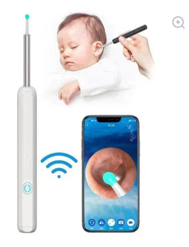 Earwax Removal Kit – Smart Visual Earwax Removal Tool