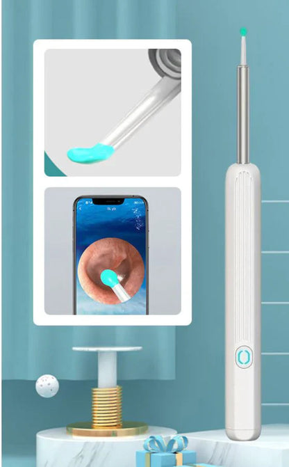 Earwax Removal Kit – Smart Visual Earwax Removal Tool