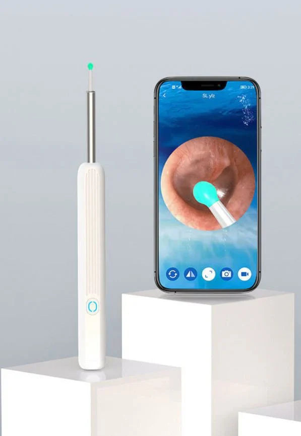 Earwax Removal Kit – Smart Visual Earwax Removal Tool
