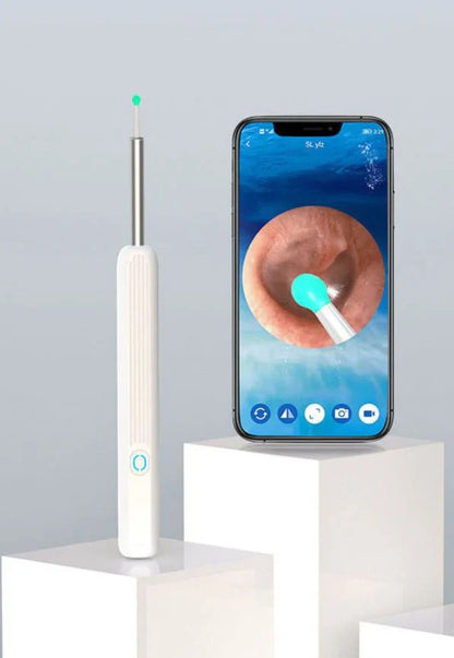 Earwax Removal Kit – Smart Visual Earwax Removal Tool